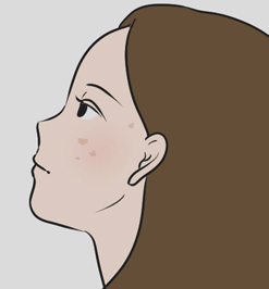 年齢による肌の違い